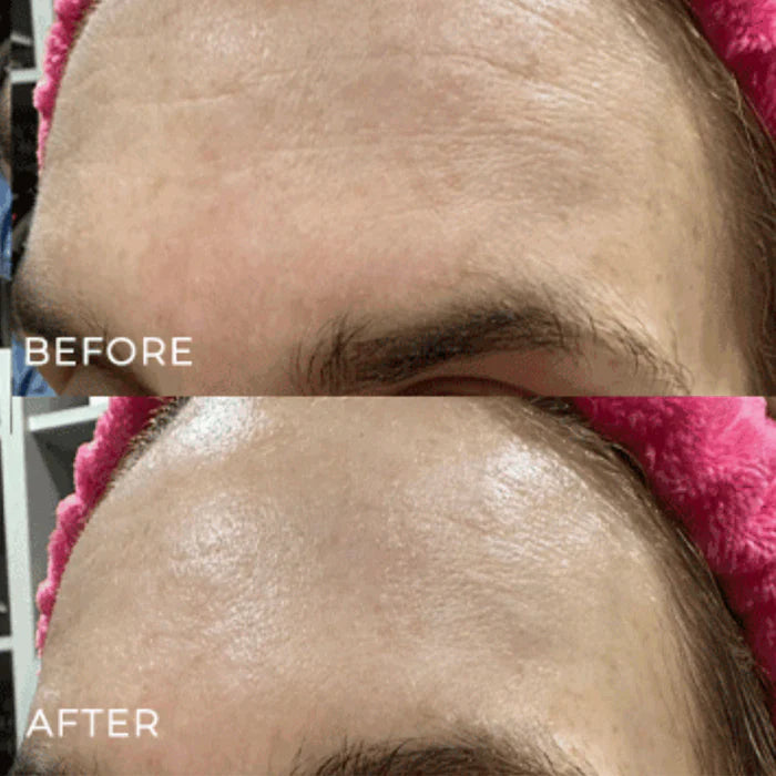 The Miracle Mask
