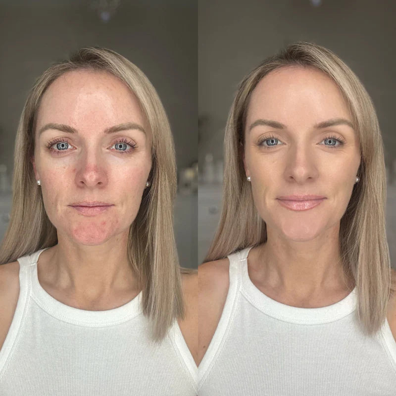 Anti-Redness Colour Corrector with SPF 30